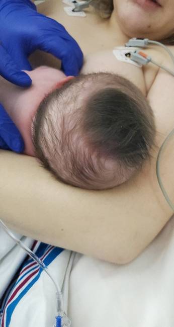 „Az újszülött lányomnak egy részen meglepően vastag a haja."