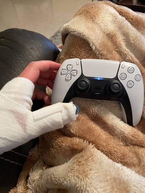 „Eltörtem az ujjam aznap, amikor végre megérkezett az új PlayStation 5-öm."