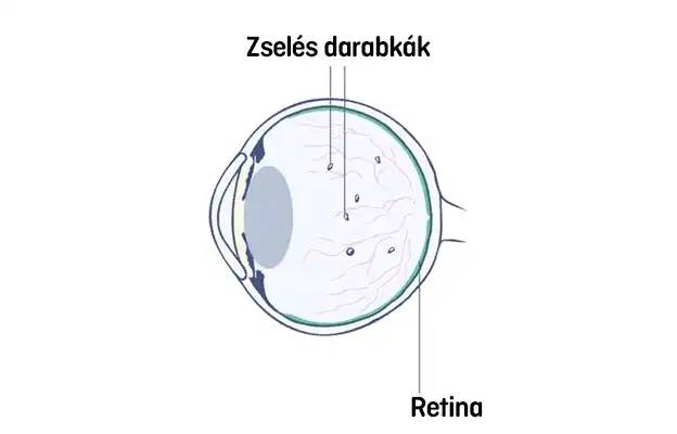 Furcsa dolgok a szemben 011
