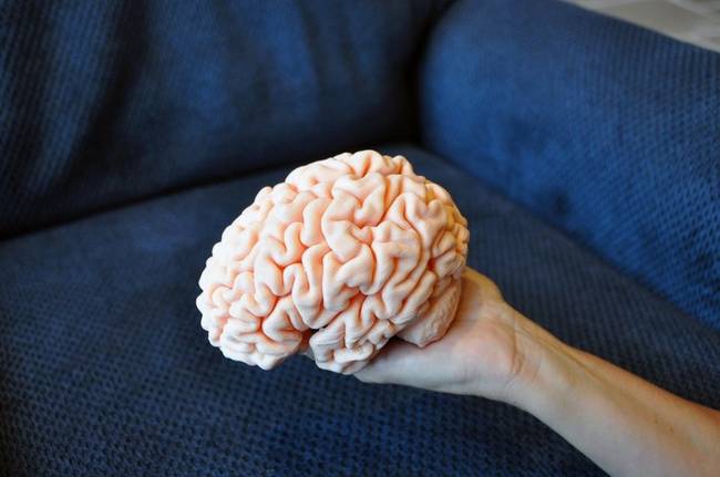 Az MRI-ből kapott adatok alapján ez a férfi elkészítette a fia agyának háromdimenziós modelljét.