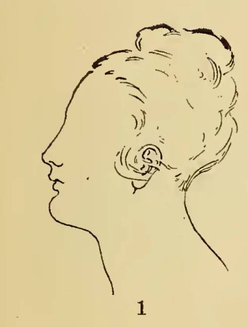 1922-ben ezeknek a képrejtvényeknek a megoldásával bizonyíthattad, hogy intelligens vagy