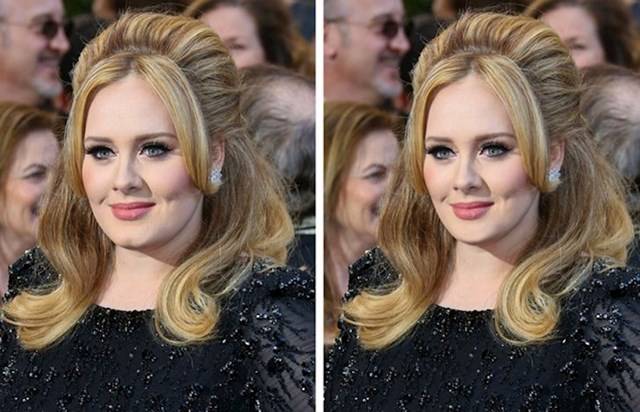 Adele és a lyuk az állán