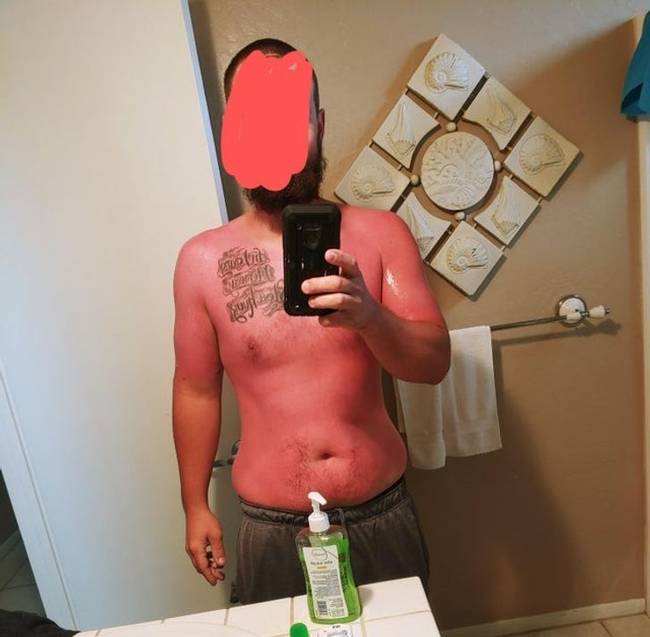 Amikor azt hiszed, hogy kolumbiai Cali-ban nem lehet leégni, mert kellemes 21 fok van, de tévedsz.