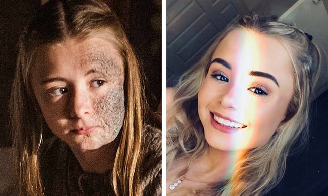 Shireen Baratheon - Kerry Ingram