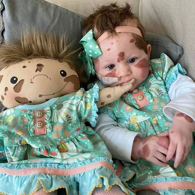 16 egyedi baba, amely segít a gyerekeknek elfogadni saját különlegességeiket