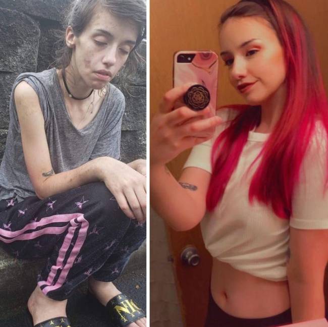 16 előtte/utána fotó, ami csak pozitív változásokat mutat