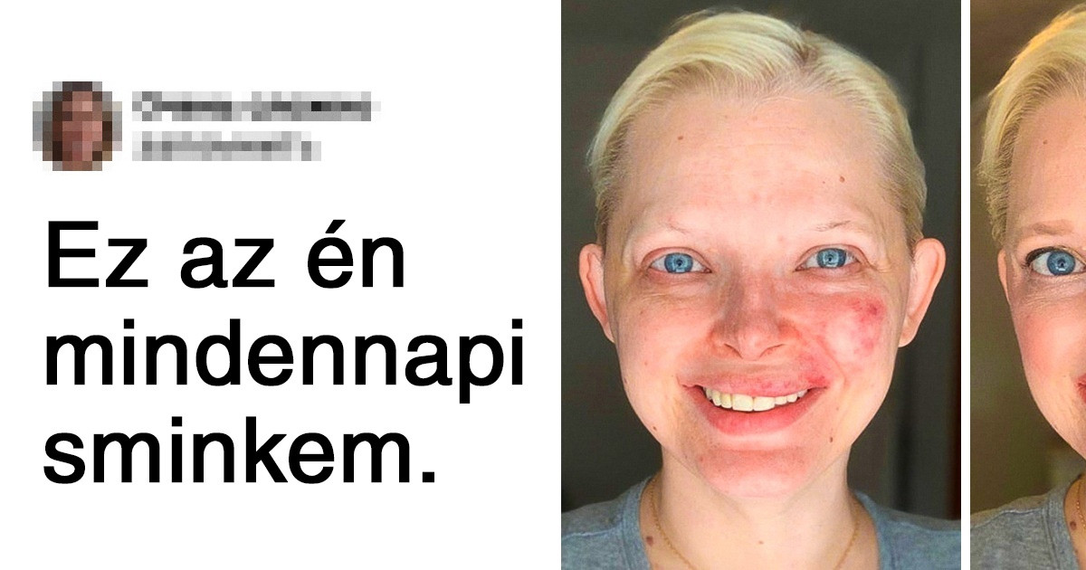 16 lány megmutatta, hogyan néz ki a "no makeup" smink felrakása előtt és után