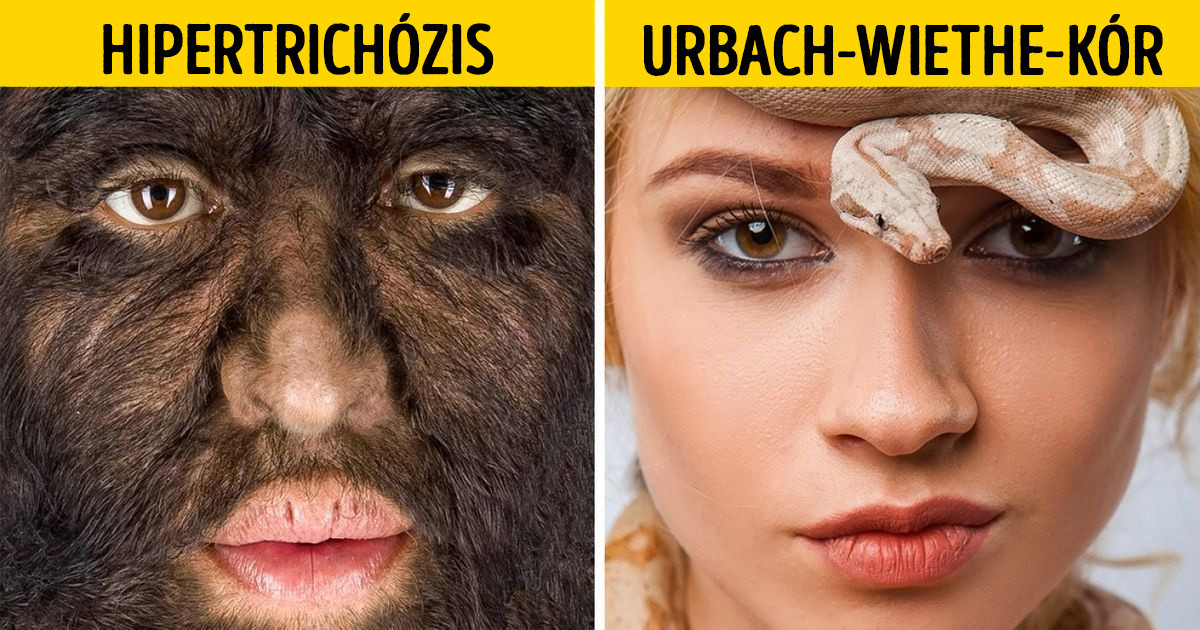 12 furcsa betegség és szindróma, ami láttán az orvosok még ma is csak szétteszik a kezüket