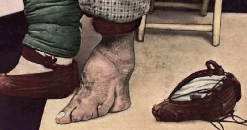 9 bizarr hagyomány, amit az emberek egykoron azért csináltak, hogy szebbnek tűnjenek