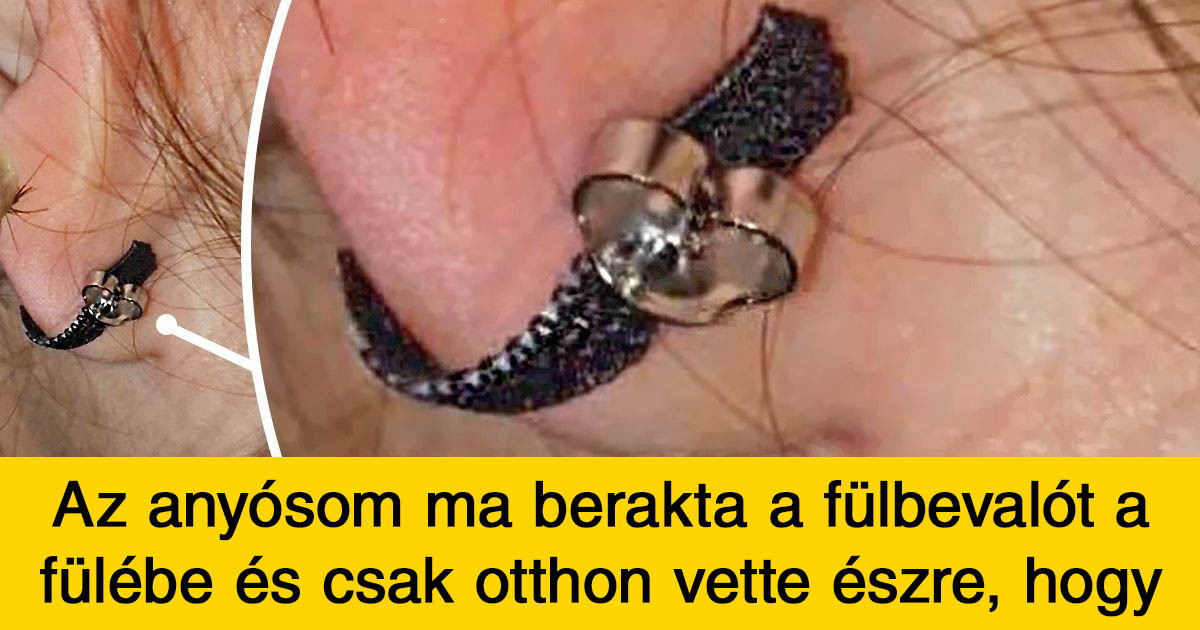 18 női baleset, aminek a fájdalmas tragédiáját egy férfi sosem lesz képes megérteni