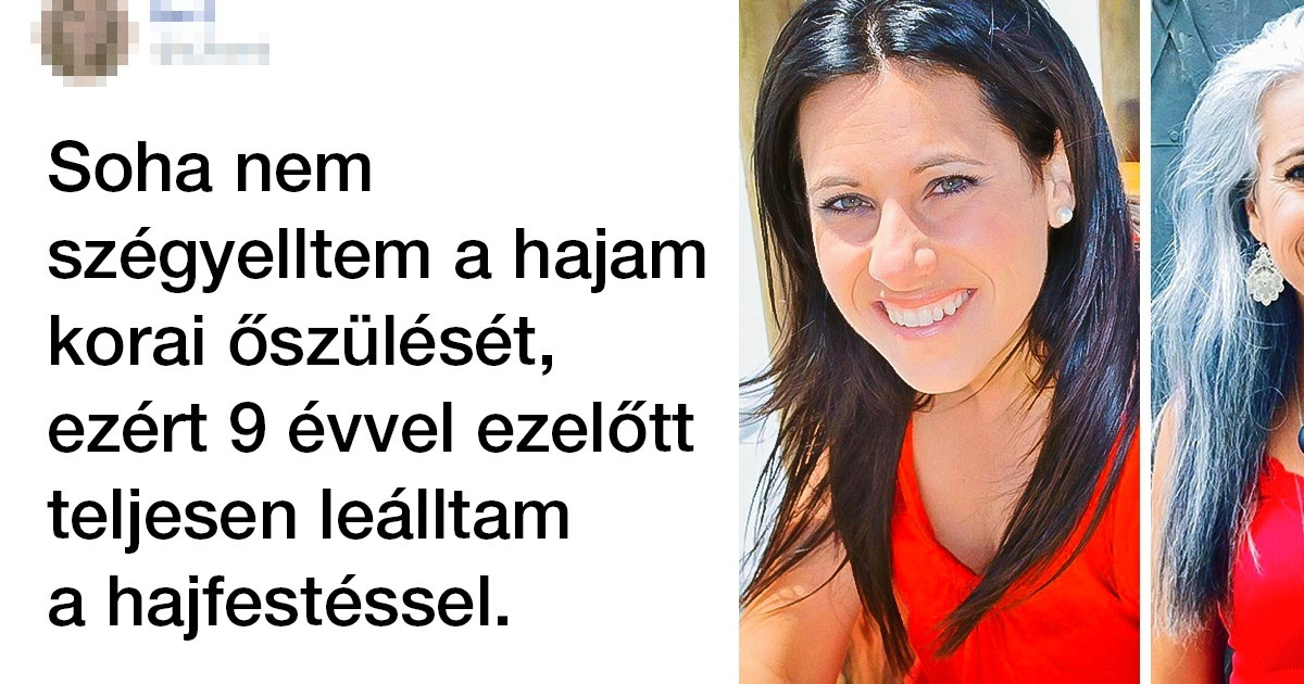 15 nő, akik elfogadták a sorsukat, és úgy döntöttek, hogy már nem rejtik el a szürke vagy ősz hajukat