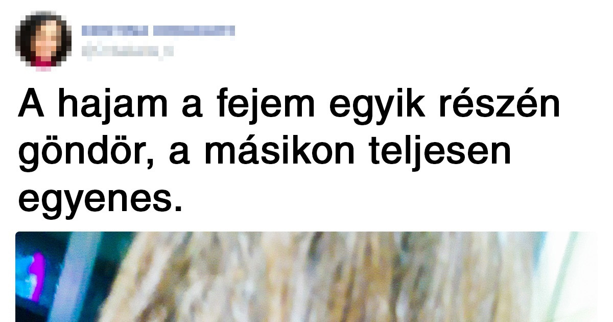 13 ember megosztotta testének azon furcsaságait, ami egyedülállóvá teszi őket a világon