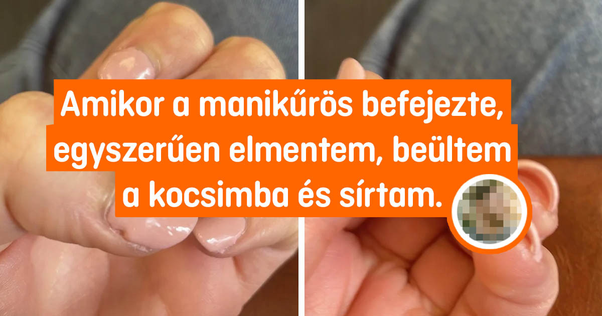15 lány, aki csak egy kicsit szebb akart lenni. De valami közbejött