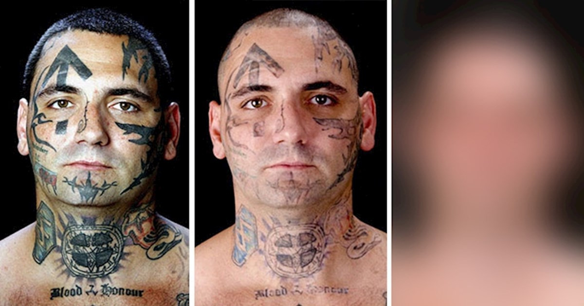 Az egykori skinhead kilépett a rasszista szervezetből, eltávolíttatta a tetoválásait, és így néz ki manapság