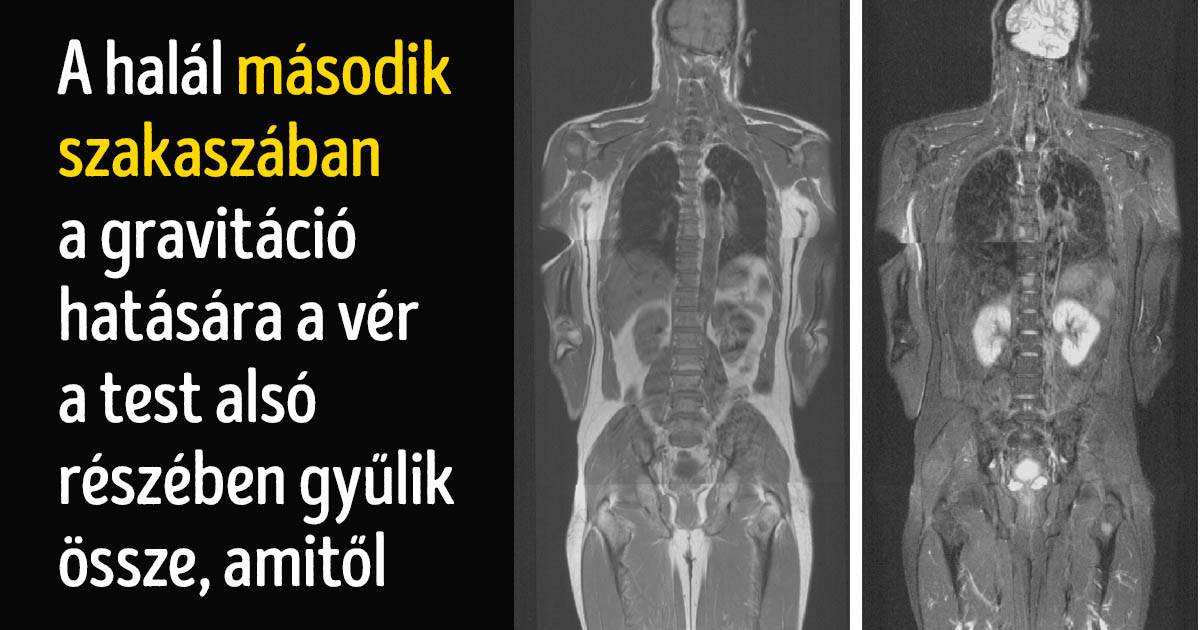 Mi történik pontosan a halál pillanatában és hogyan változik utána a testünk