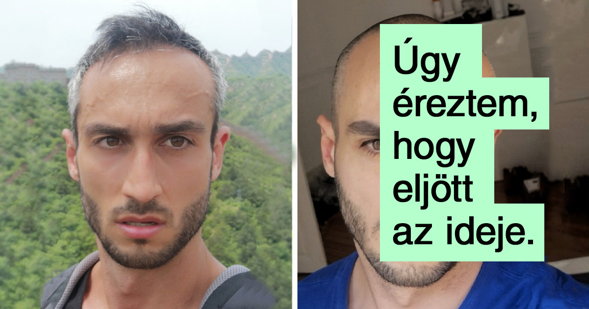 20 férfi, aki úgy döntött, hogy kipróbálja a kopaszságot, és egy percig sem bánta meg