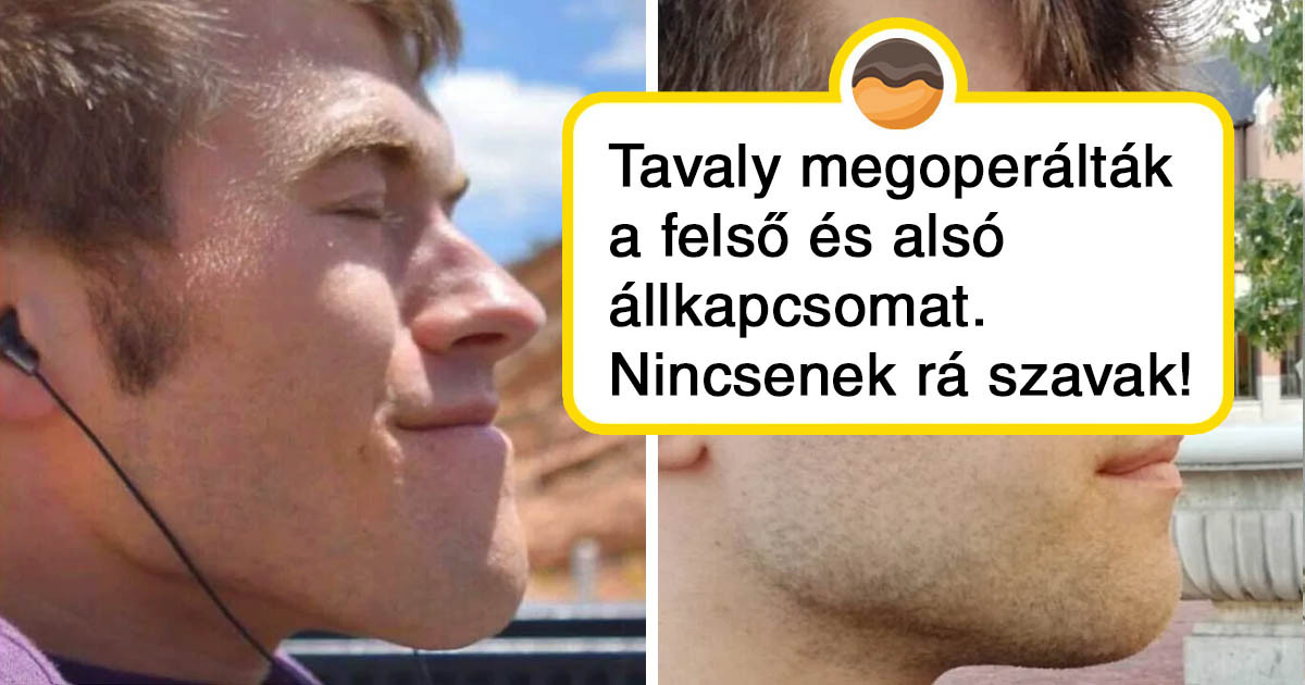 19 ember, aki plasztikai műtét mellett döntött, és megütötte vele a főnyereményt