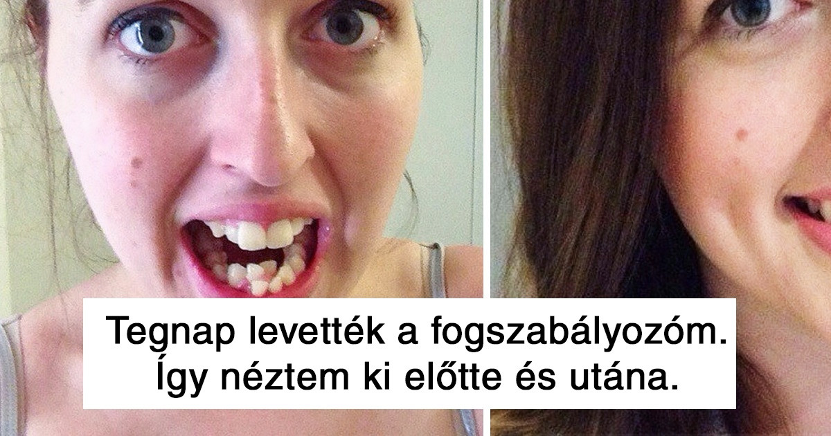 Az internetezők megmutatták, hogyan változott a megjelenésük, miután egyvalamit kijavítottak magukon