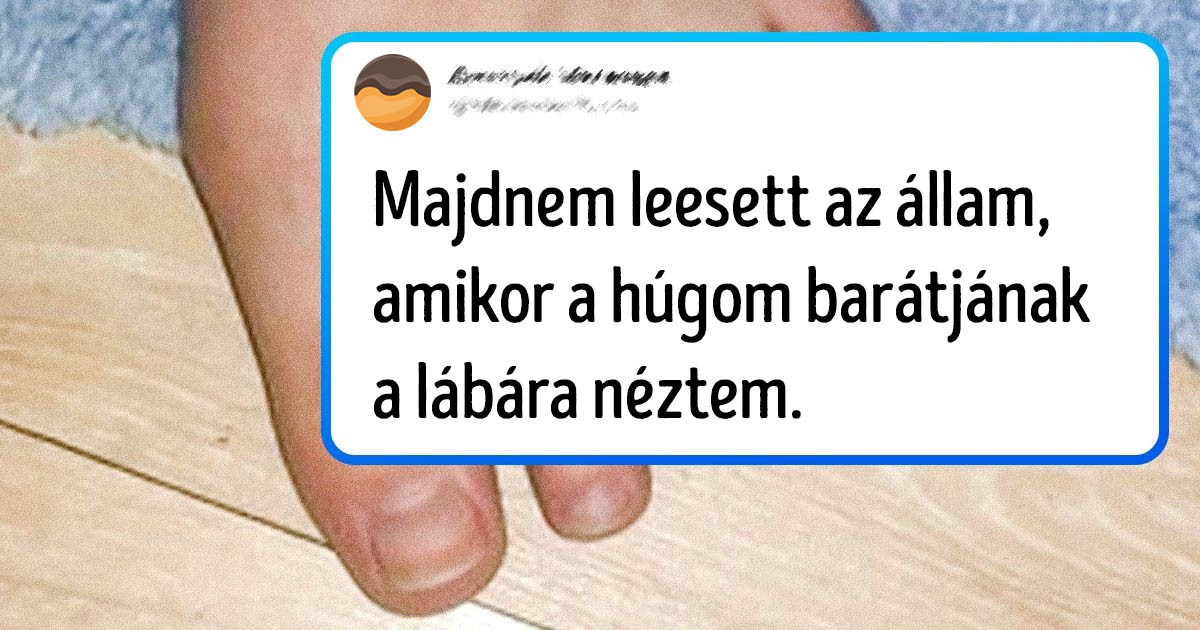 A genetika nagyon különlegessé tudja tenni az emberek megjelenését, és ezt most 15 fotóval is bizonyítjuk