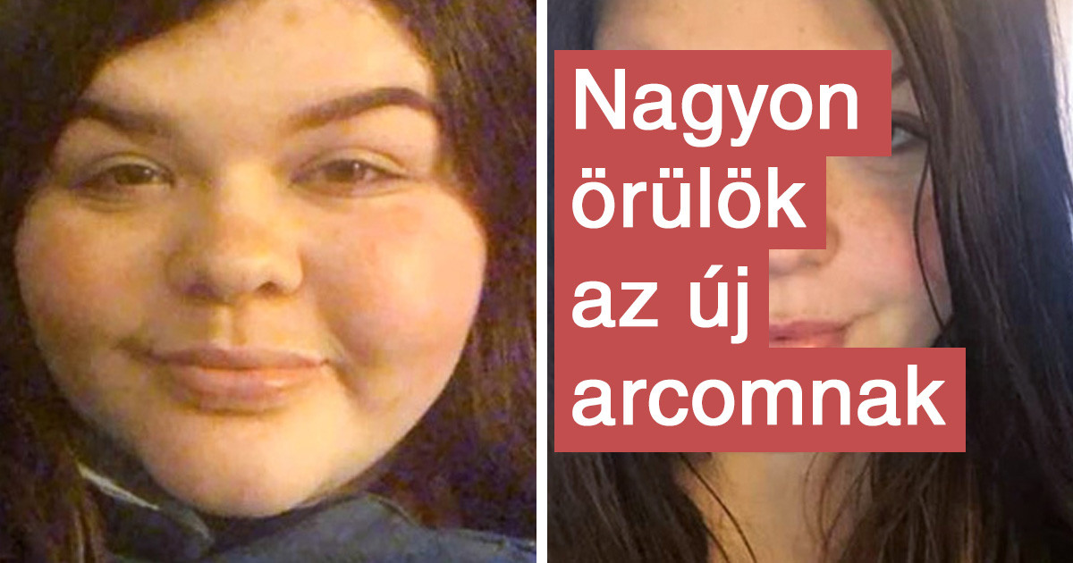 Az emberek megmutatták, hogyan sikerült lefogyniuk egy speciális étrendnek köszönhetően
