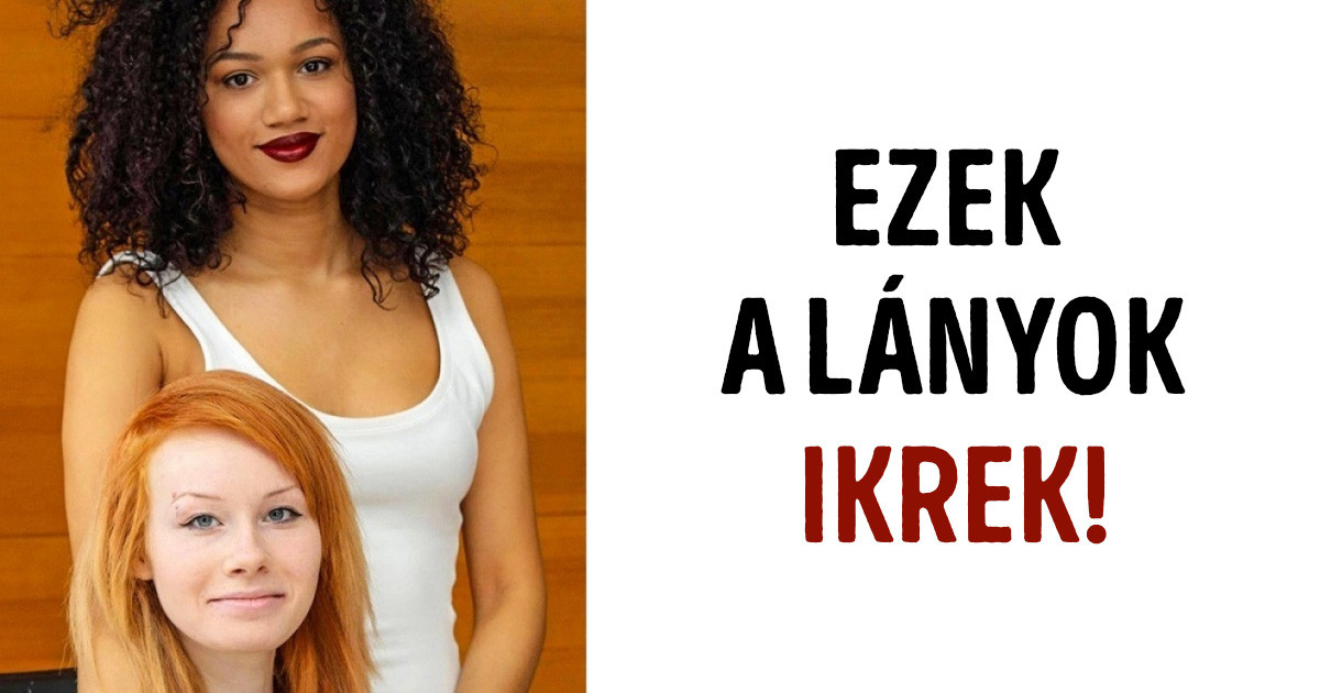 20 kép, ami bizonyítja, hogy a genetika olykor teljesen kiszámíthatatlan