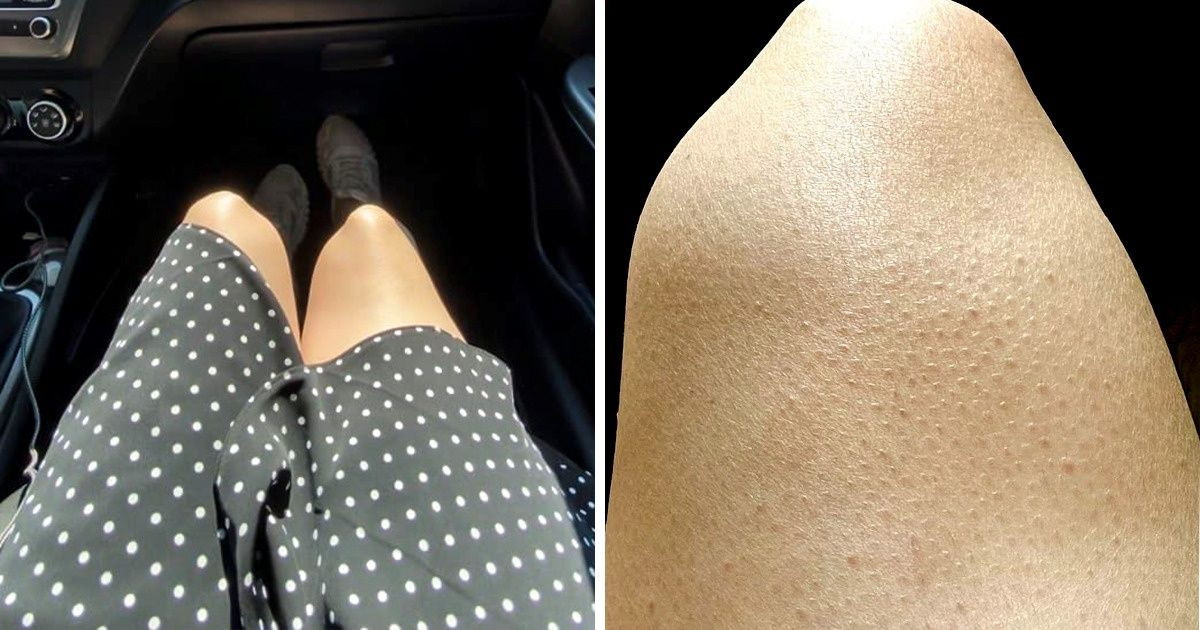 9 fizikai jellemző, amit sok nő szépséghibának tart, pedig nem így van