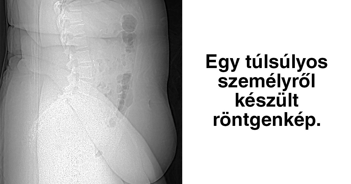 16 elképesztő felvétel az emberi testről, amit sosem tudnánk egy hétköznapi kamerával megismételni
