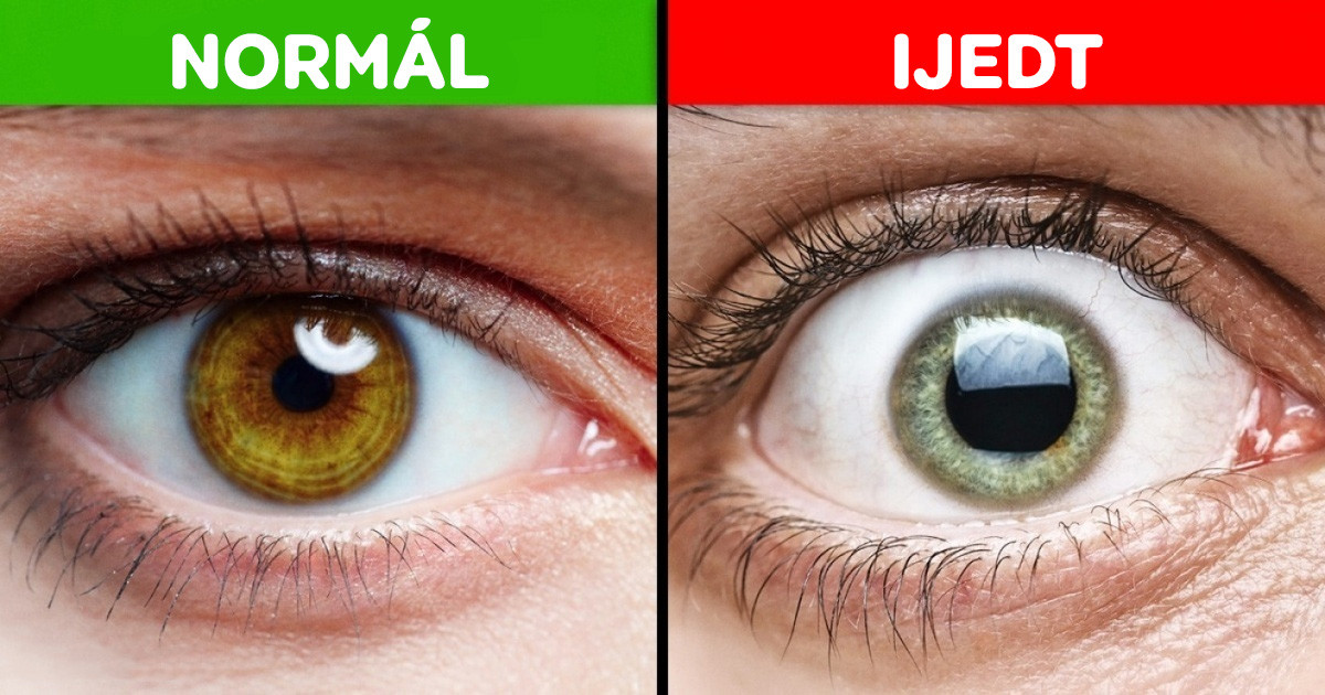 19 izgalmas tény az emberi testről, amit sosem gondoltunk volna korábban