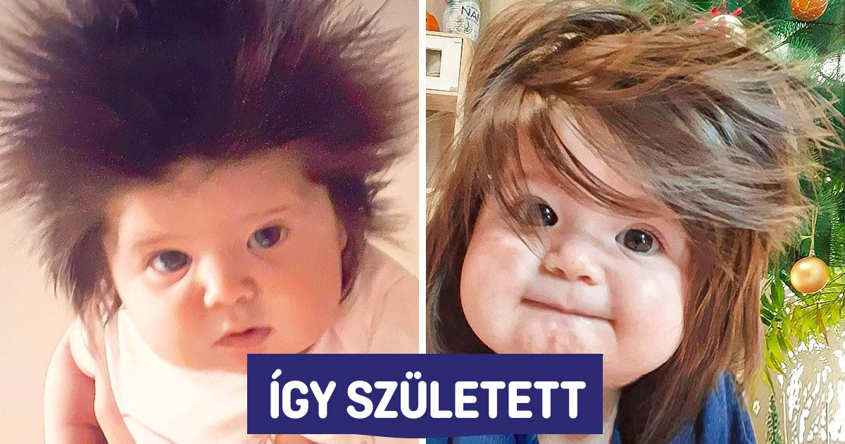 18 ember, aki extra áldást kapott az anyatermészettől