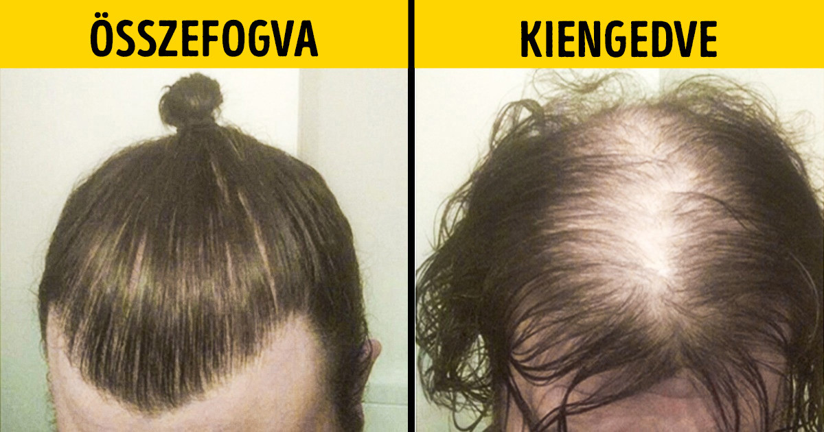 18 fotó, ami bizonyítja, hogy minden frizura mögött érdekes történet rejlik
