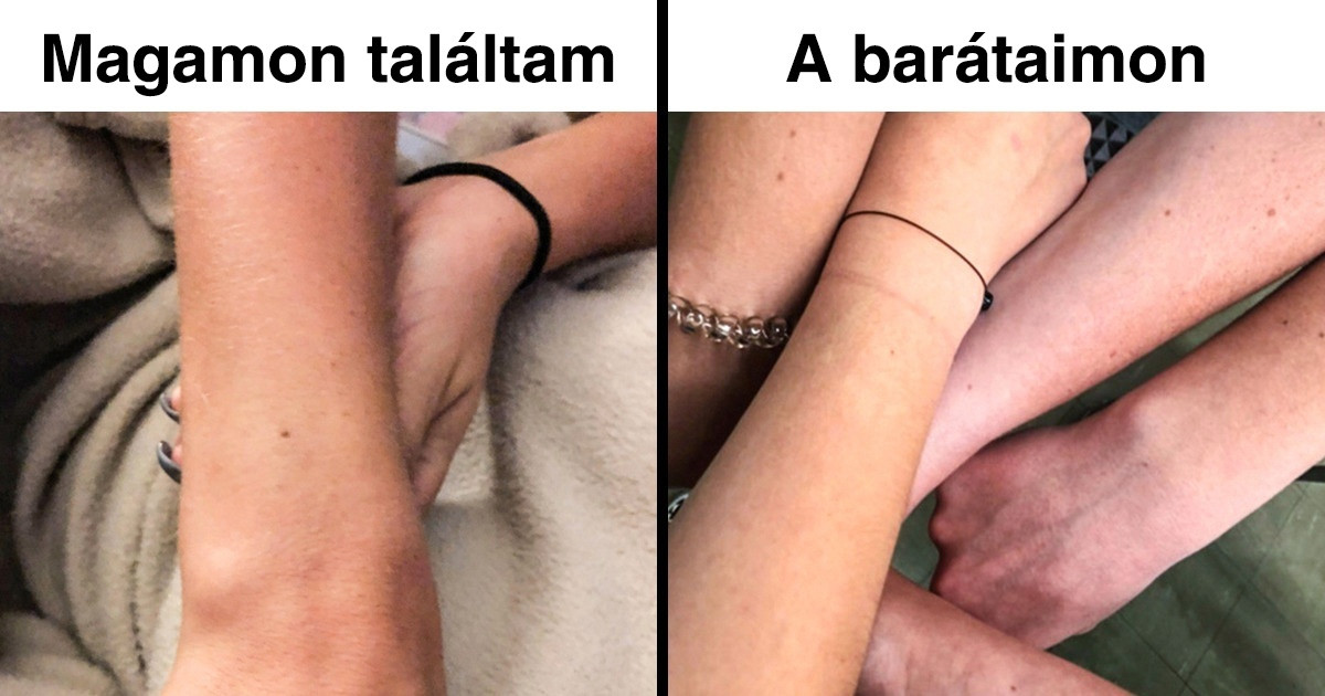 Egy véletlen Tweetből kiderült, hogy a világon majdnem minden nőnek pontosan ugyanolyan anyajegye van