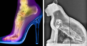 Röntgensugarak rejtett világ
