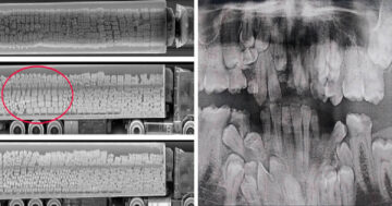 Röntgensugarak képek