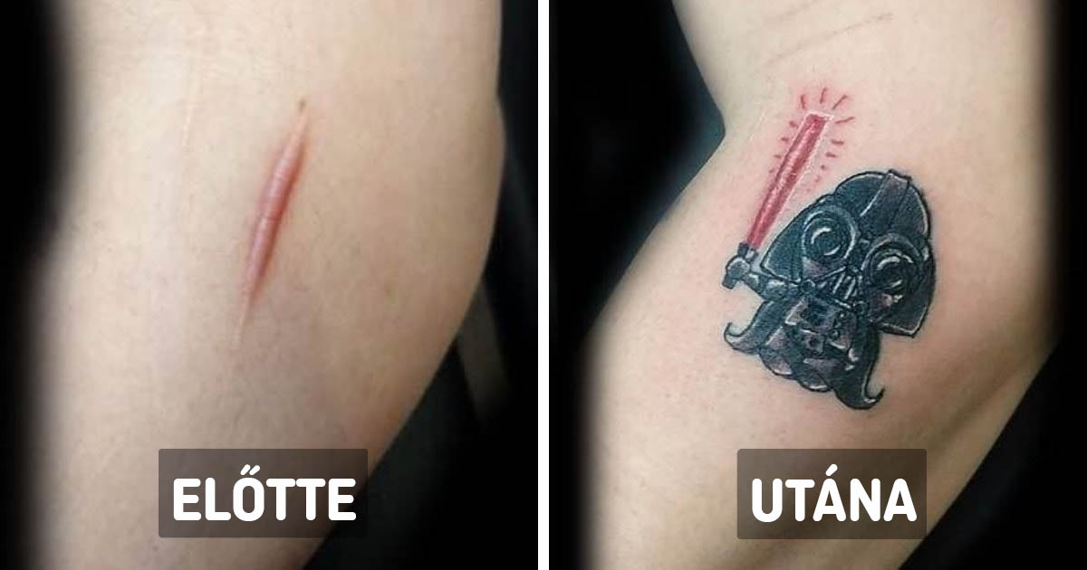 Előtte utána tetoválások