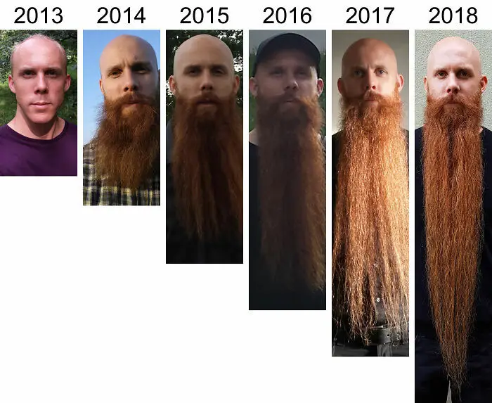 Férfi szakáll előtte utána 4