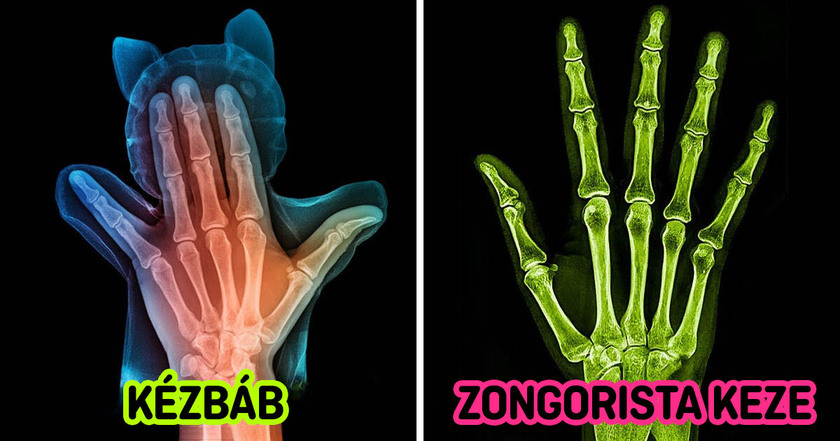 Röntgenképek
