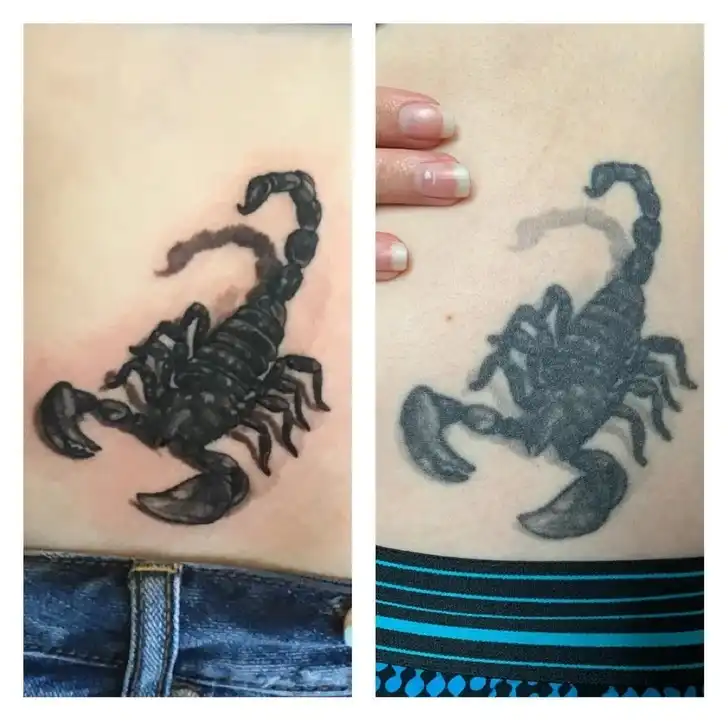 Tetoválás változások 011