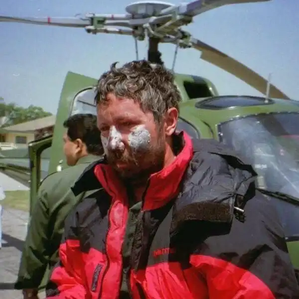 Az ember, akit kétszer is hagytak meghalni az Everesten. Beck Weathers lenyűgöző története 1996-os Mount Everest tragédia, amputáció, Beck Weathers, emberi kitartás, fagyás, hegymászás, inspiráló történetek, katasztrófa, Mount Everest, túlélés