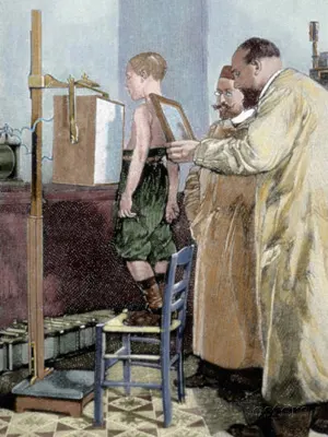 Amit Wilhelm Röntgen félt elmondani az embereknek életrajz, felfedezés, fizika, Nobel-díj, röntgen, röntgensugárzás, tudománytörténet, tudósok, Wilhelm Conrad Röntgen, X-sugár