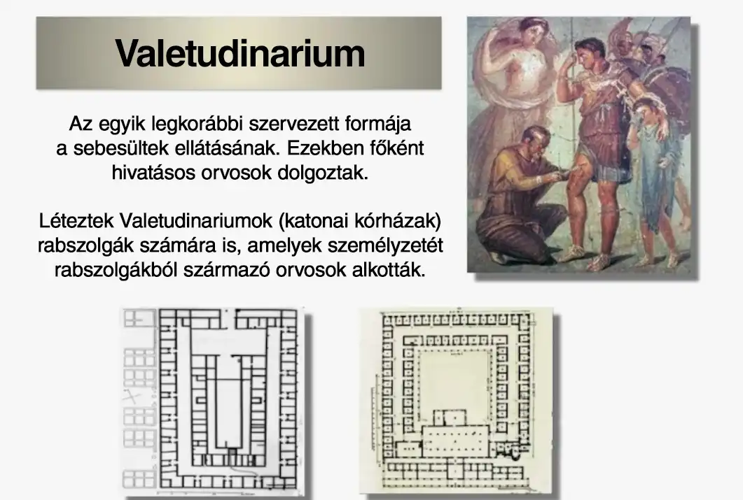 Mit csináltak régen a sebesültekkel a csaták után? Elmesélem részletesen ellátás, hadsereg, hadviselés, Katonák, Koraújkor, középkor, Ókor, Orvoslás, Sebesültek, történelem