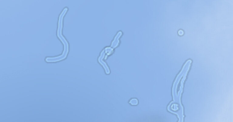 Lebegő foltok a szem előtt: Mi okozza a furcsa jelenséget?