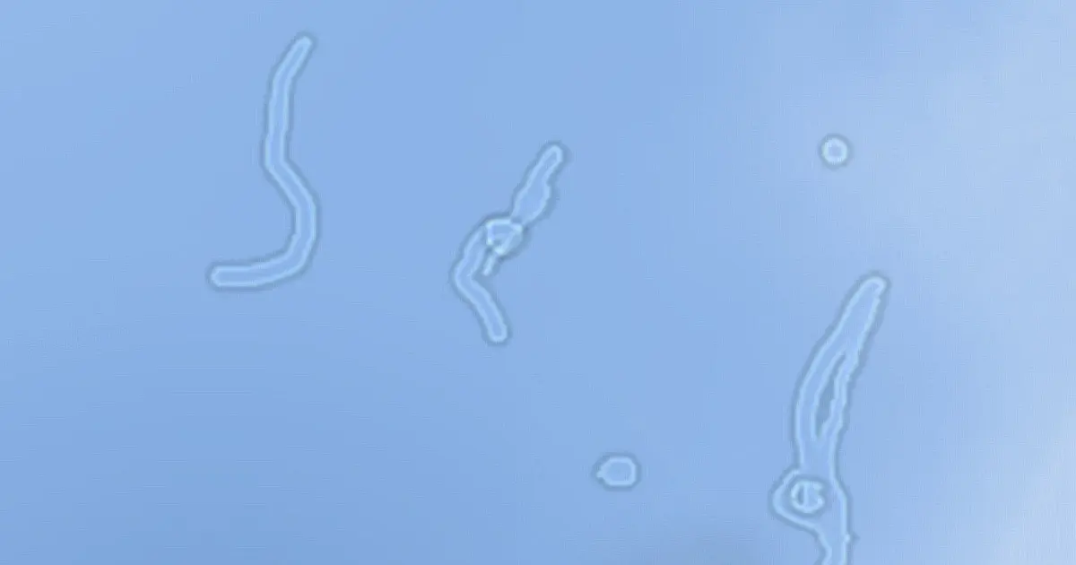 Mik ezek a furcsa dolgok, amik néha a szemünk előtt lebegnek?