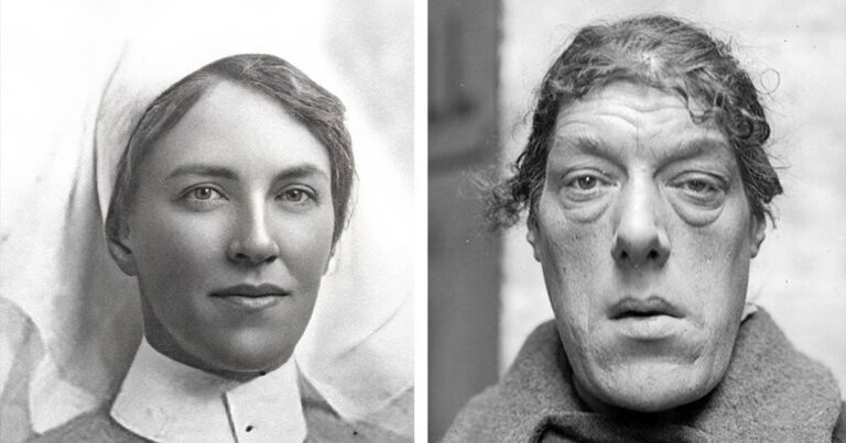 Szépségből szörnyeteg: A „világ legrondább nőjének” története, Mary Ann Webster