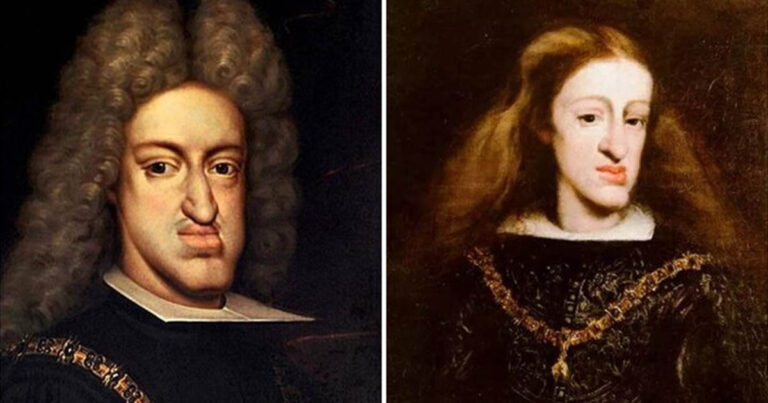 Mi történt a Habsburgok állkapcsával?