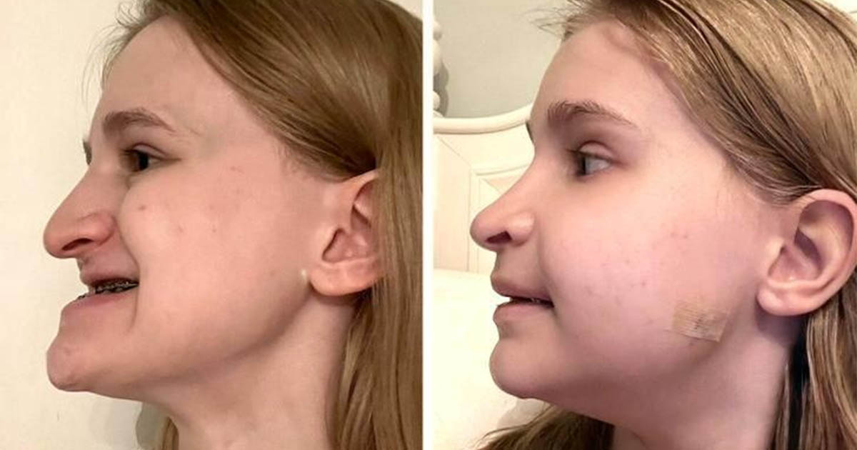 15+ eset, amikor egy apró részlet hatalmas különbséget jelentett