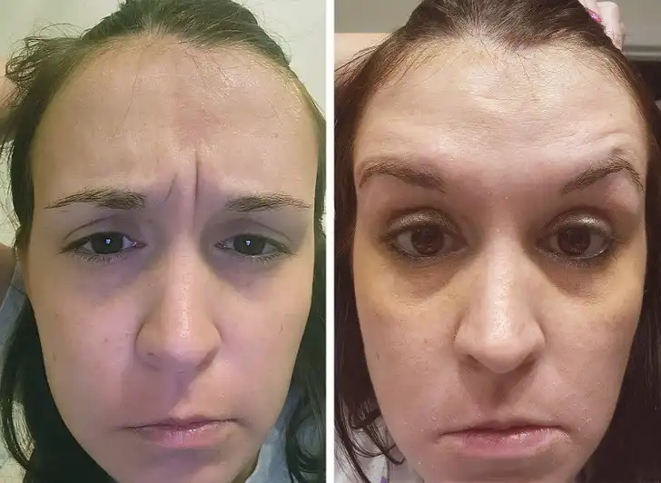 15+ Apró Részlet, Hatalmas Különbség: Megdöbbentő Átalakulások