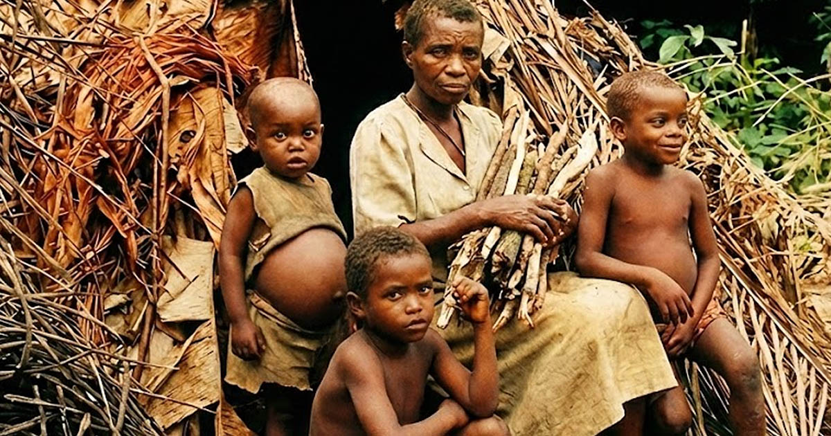 Miért van gyakran nagy hasa az egyébként éhező afrikai gyerekeknek?