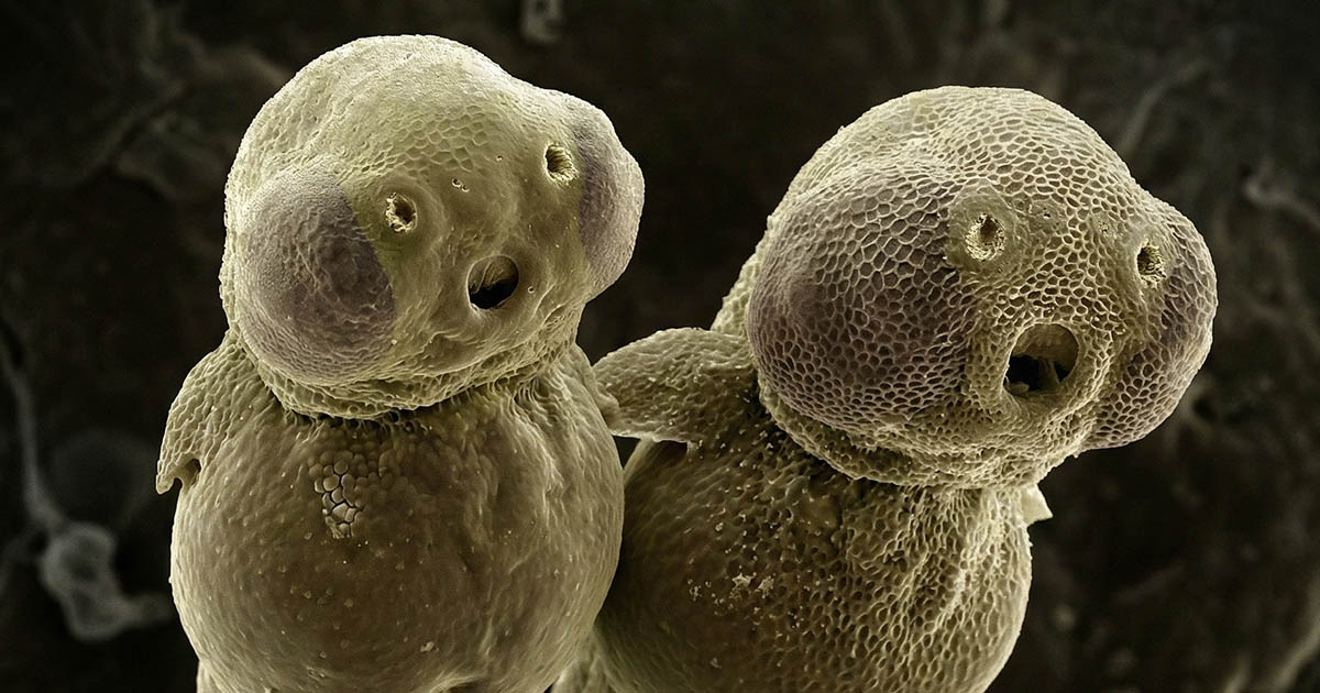 15 csodálatos makrofotó, ami segít jobban megismerni a minket körülvevő világot