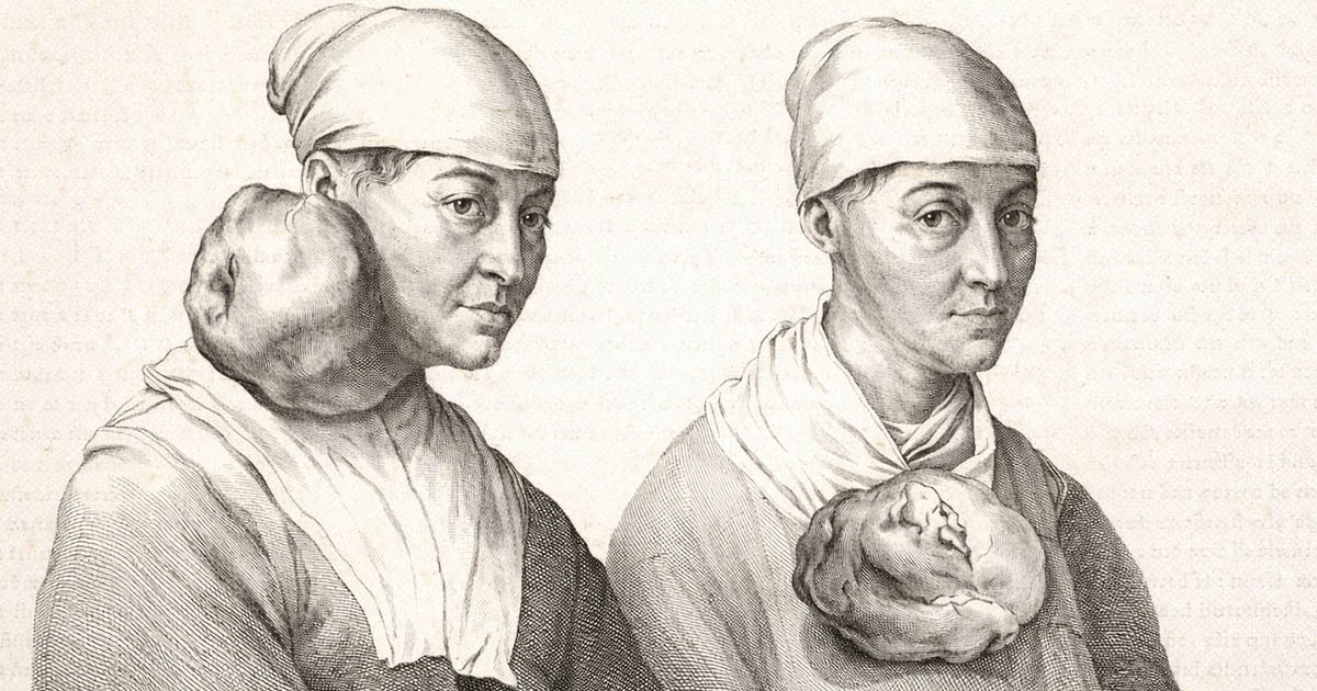 32 „előtte-utána” kép, amelyeket egyszerűen muszáj megnézni