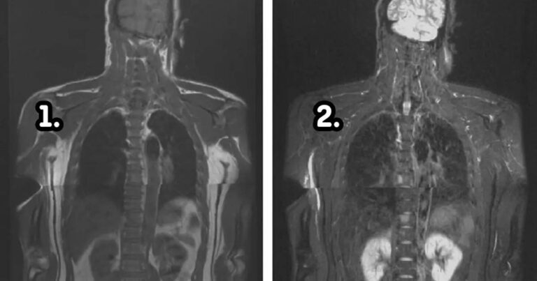 Milyen változások mennek végbe a testben a halál után? 15 elképesztő folyamat